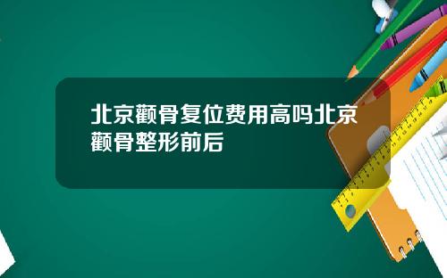 北京颧骨复位费用高吗北京颧骨整形前后